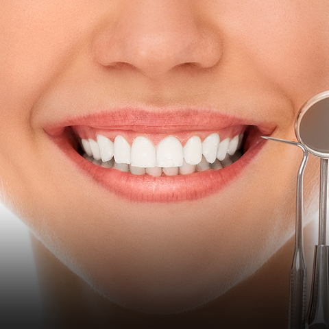 실활치미백(신경치료 후 변색 치아 미백)